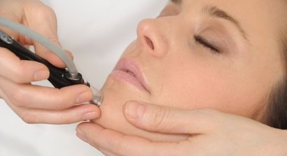 Peelings (Diamantpeeling, chemische Peelings)