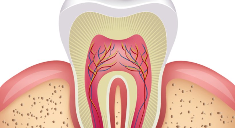 Wurzelbehandlung - Dr. Evelyn Raab-Kronister - Zahnärztin Deutsch-Wagram 2232
