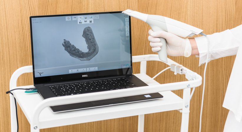 Digitale Kieferorthopädie - DDr. Elisabeth Pittschieler - Zahnärztin Wien 1010