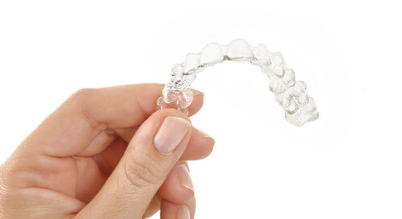 Aligner-Schienen  - DDr. Elisabeth Pittschieler - Zahnärztin Wien 1010