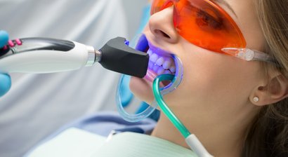 Bleaching (Zahnaufhellung)