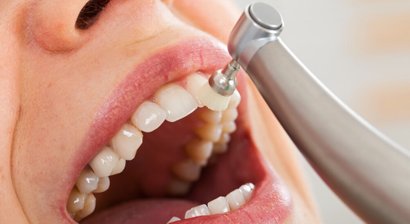 Professionelle Mundhygiene / Zahnprophylaxe