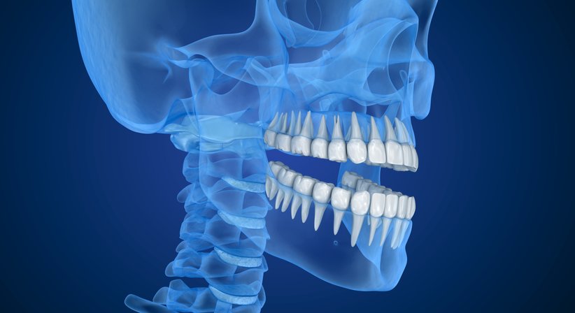 3D-Röntgen / DVT (digitale Volumentomographie) - Dr. Daniel Bank - Zahnarzt Wien 1040