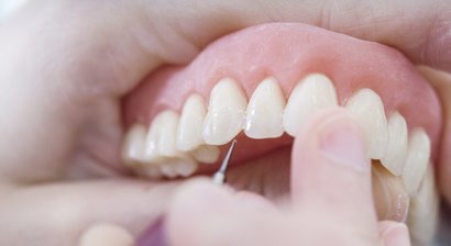 Zahnprothesen (Prothetik)