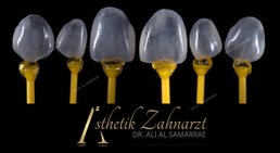 Dr. med. dent. Ali Al-Samarrae - Zahnarzt Wien 1040