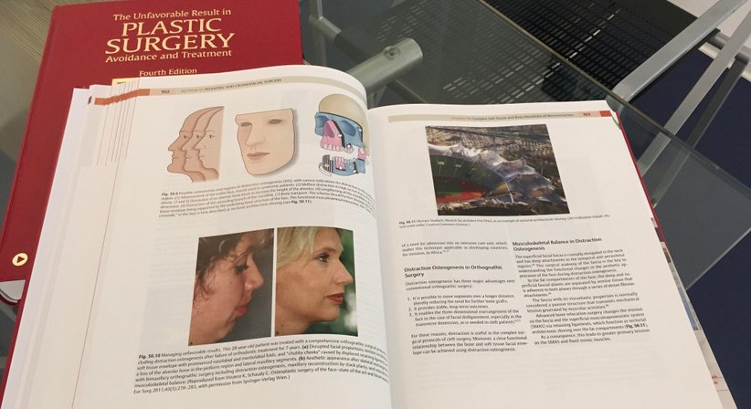 Ästhetische Gesichtschirurgie zur Gesichtsverjüngung im Gesamtspektrum der Gesichtsalterung - Univ.-Prof. DDr. Kurt Vinzenz - Kieferchirurg Wien 1010