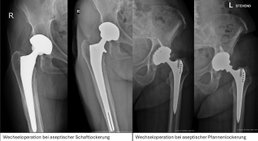 Priv.-Doz. DDr. Jörg Friesenbichler - Orthopäde Rosental an der Kainach 8582