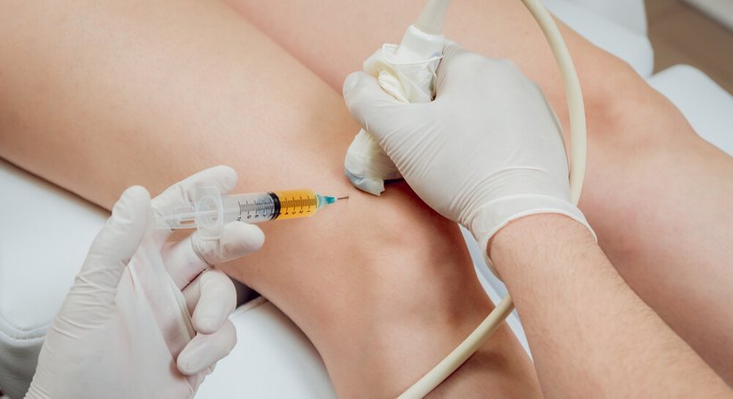 ACP-Therapie (Eigenbluttherapie) - OA Dr. Clemens Felsing - Orthopäde Wien 1190