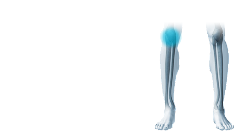 Meniskusriss - Prof. Dr. Klaus Schatz - Orthopäde Wien 1010