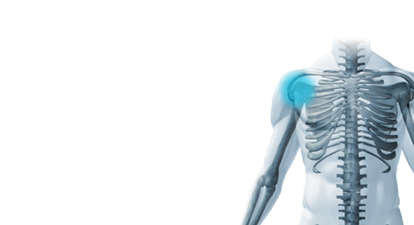 Rotatorenmanschette (Sehnenriss Schulter) - Prof. Dr. Klaus Schatz - Orthopäde Wien 1010