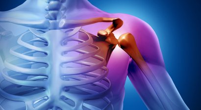 Schulterarthrose, Schulterprothese