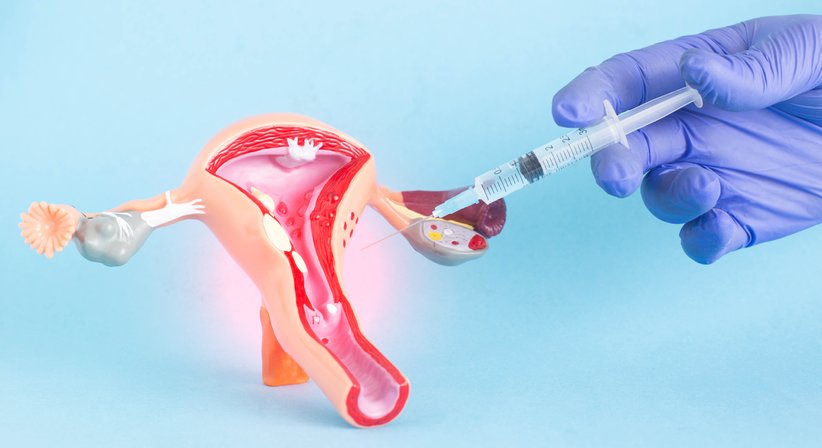 Schamlippenkorrektur - Doz. Dr. Georg Huemer - Plastischer Chirurg Linz 4020