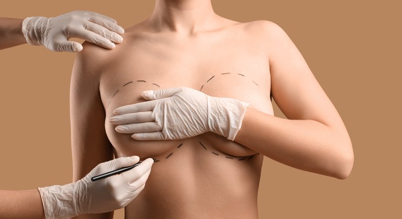 Brustchirurgie - Doz. Dr. Georg Huemer - Plastischer Chirurg Linz 4020