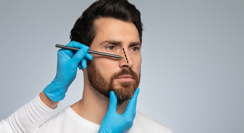 Nasenkorrektur - Doz. Dr. Georg Huemer - Plastischer Chirurg Linz 4020