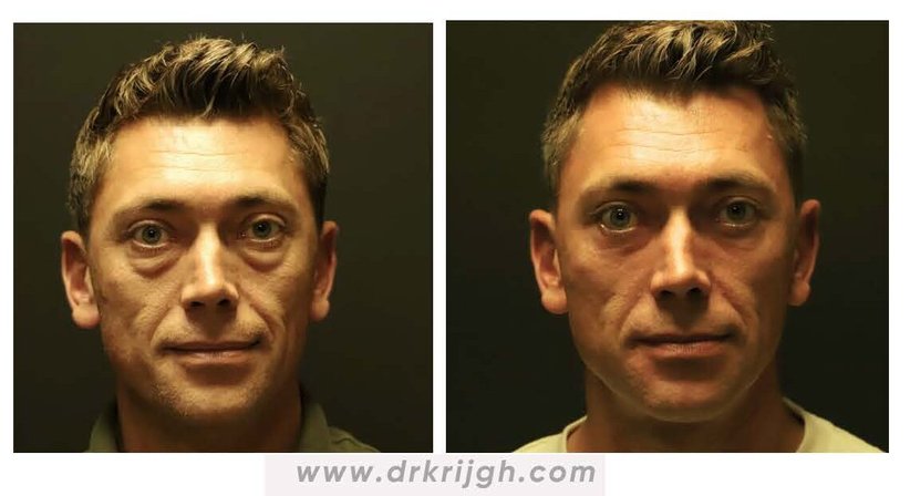 Plastische, Rekonstruktive, Ästhetische und Handchirurgie.  - David Krijgh - Plastischer Chirurg Aspang 2870