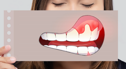 Zahnfleischbehandlungen