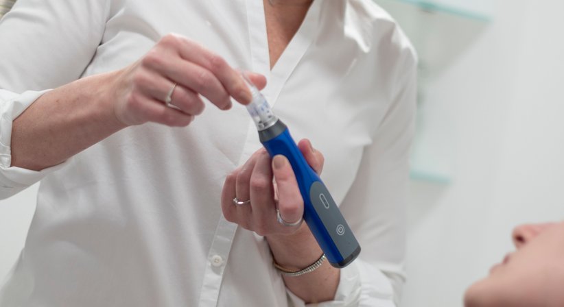 Medizinisches Microneedling & Polynukleotide aus Lachs-DNA bei Dr. Sonja Lattenmayer-Meizer