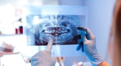 Oralchirurgische Eingriffe