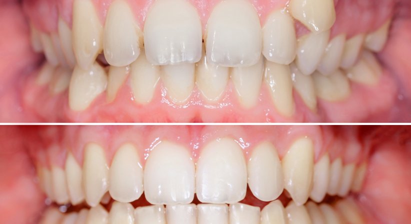 Kieferorthopädie - Dr. Sehdi Sarmini - Zahnarzt Salzburg 5020