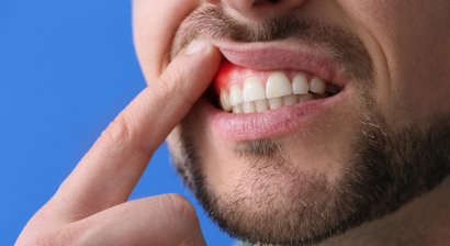 Parodontalbehandlung