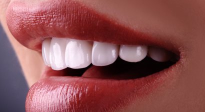 Bleaching (In-Office und To-Go)