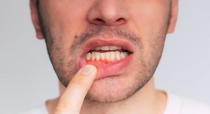 Parodontalbehandlung