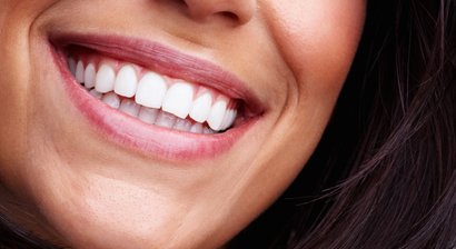 Professionelle Mundhygiene (Zahnprophylaxe)