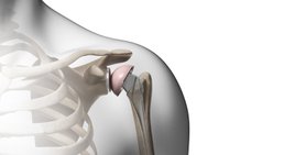 OA Dr. Stefan Eipeldauer - Orthopäde Baden 2500