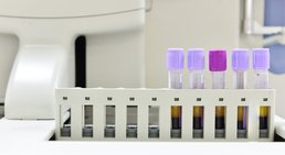 OA Dr. Stefan Eipeldauer - Orthopäde Baden 2500