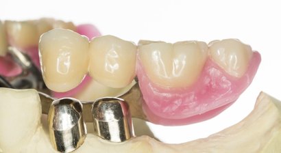 Teil- und Totalprothesen