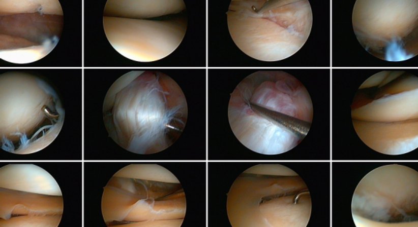 Arthroskopie - Dr. med. univ. Vedat Sahin - Orthopäde Wien 1230
