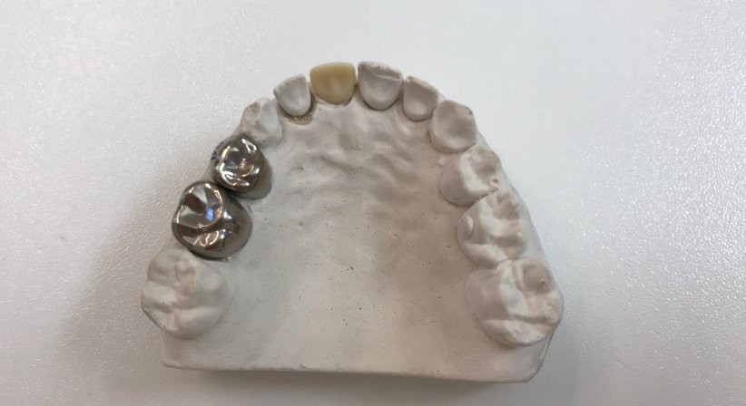 Kinderzahnheilkunde - Dr. Katrin Köllensperger - Zahnärztin Wien 1190