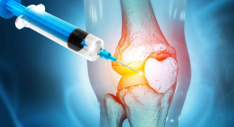 Knorpelaufbau (Hyaluronsäuretherapie) - OA Dr. Daniel Schallmayer - Orthopäde Wien 1140