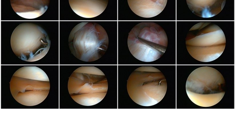 Arthroskopie (Knie, Schulter) - Mag. Dr. Manfred Neumaier - Orthopäde Pottendorf 2486