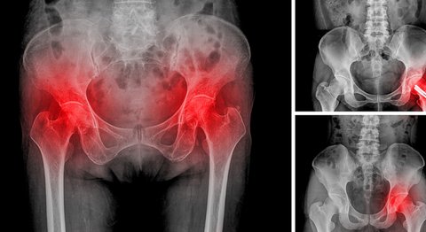 Mag. Dr. Manfred Neumaier - Orthopäde Pottendorf 2486