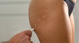 Priv.-Doz. Dr. Stefan Hacker, FEBOPRAS - Plastischer Chirurg Wieselburg 3250