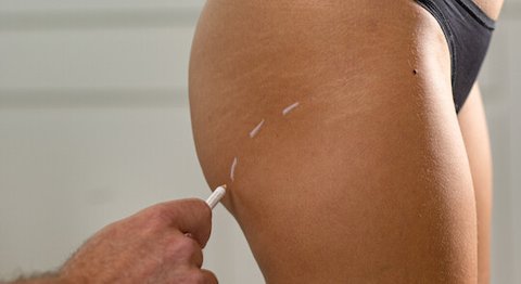 Praxis - Priv.-Doz. Dr. Stefan Hacker, FEBOPRAS - Plastischer Chirurg Wieselburg 3250