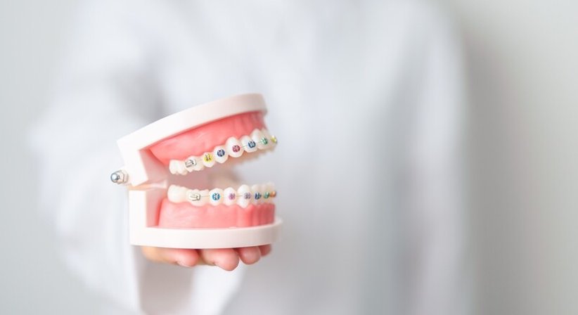 Kieferorthopädie - Dr. Winfried Wiesinger - Zahnarzt Amstetten 3300