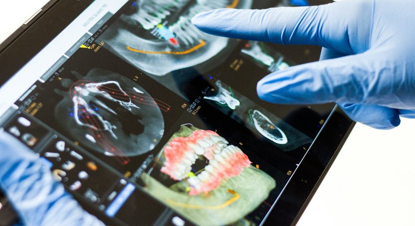 3D-Röntgen mit DVT – Präzision für Ihre sichere Zahnbehandlung - Dr. med. dent. Manuel Rammer-Viden - Zahnarzt Gallneukirchen 4210