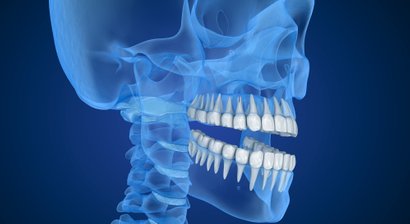 3D-Röntgen – DVT: Rundumabbild bis ins kleinste Detail