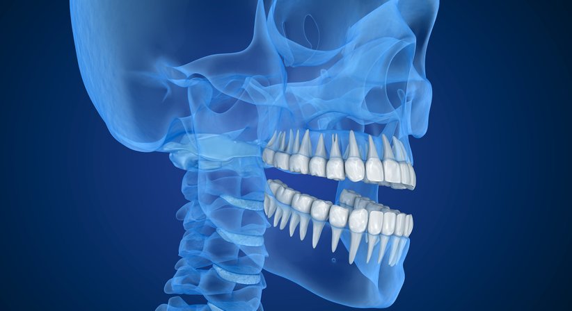 3D-Röntgen – DVT: Rundumabbild bis ins kleinste Detail - DDr. Florian Six - Zahnarzt Wels 4600