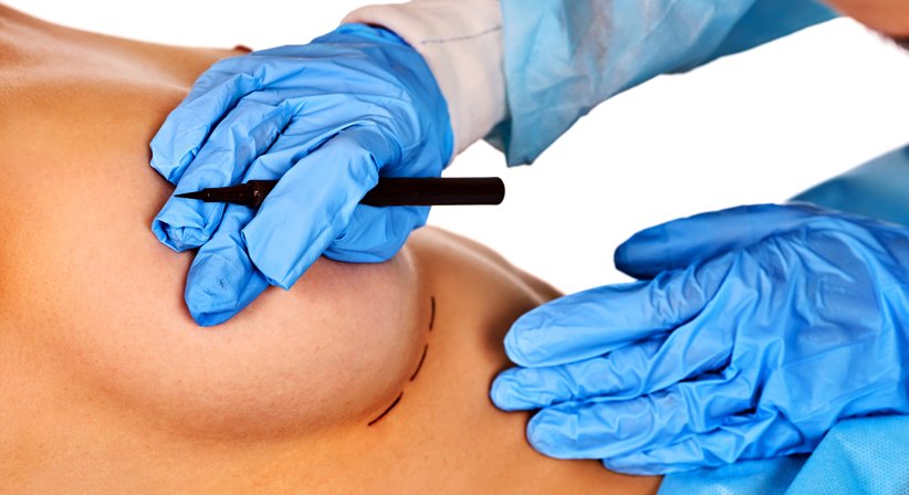 Brustchirurgie - Dr. Günter Schmid - Plastischer Chirurg Feldkirch 6800