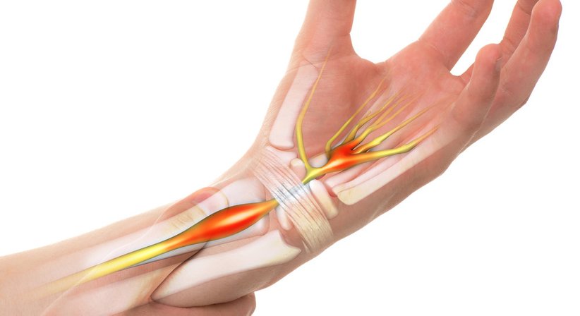 Handchirurgie - Dr. Günter Schmid - Plastischer Chirurg Feldkirch 6800