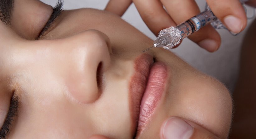 Filler / Hyaluronsäure - Dr. med univ. Christian Wolf, Executive MBA - Plastischer Chirurg Salzburg 5020