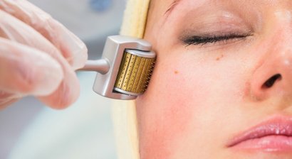 Microneedling mit Radiofrequenz