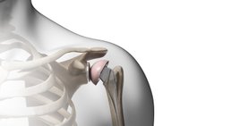 Priv.-Doz. Mag. Dr. Thomas Hoffelner, MSc - Orthopäde Wien 1010