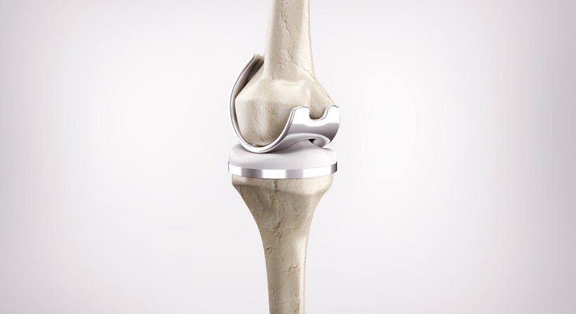 Endoprothetik - Dr. med. univ. Richard Kellner - Orthopäde Wien 1010