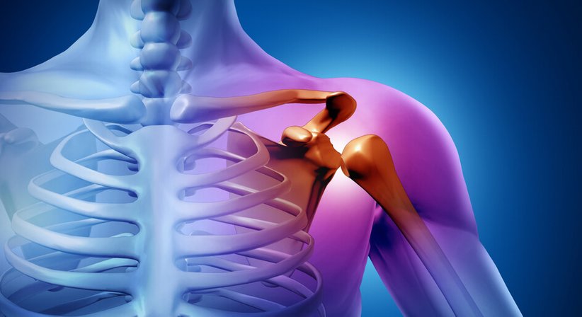 Schulterluxation - Dr. med. univ. Richard Kellner - Orthopäde Wien 1010