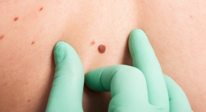 Allgemeine Dermatologie