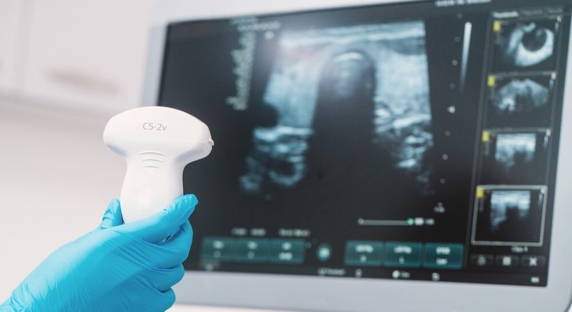 Sonographie - Dr. Rodrigo Suarez Ibarolla - Urologe Wien 1030